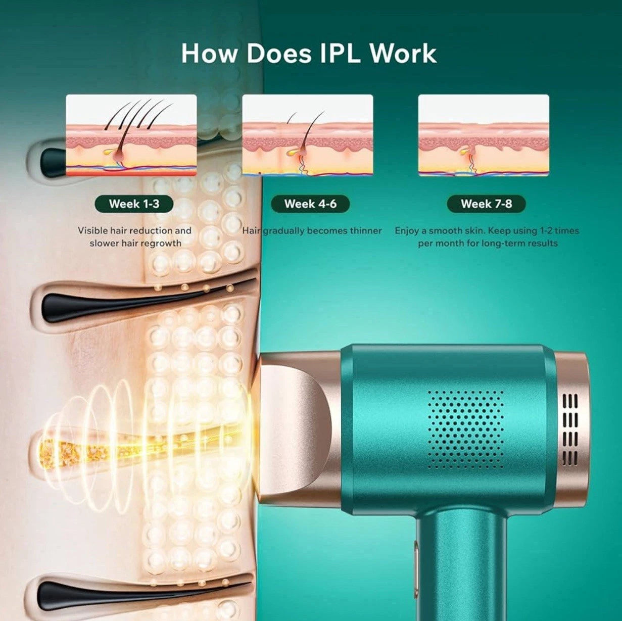 IPL Laser Hair Removal Device