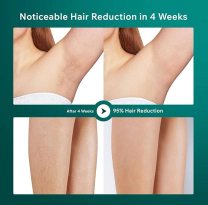 IPL Laser Hair Removal Device